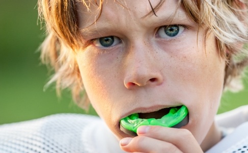 Teen placing an athletic mouthguard