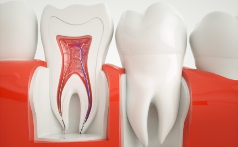 Animated smile showing damaged teeth prior to tooth extractions