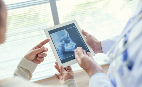 X-ray showing jaw and skull to plan equilibration and occlusal adjustment