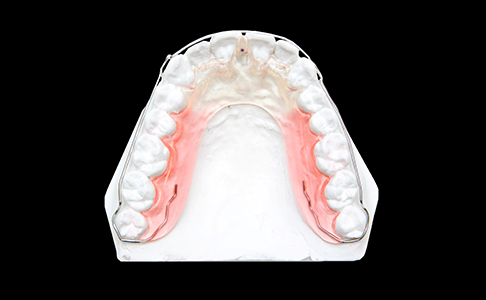 Model smile with occlusal splint in place